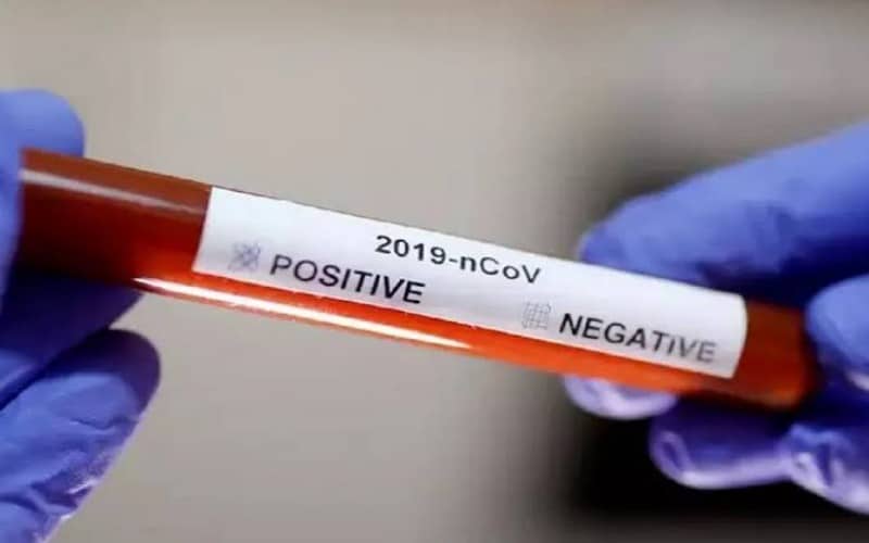 corona virus