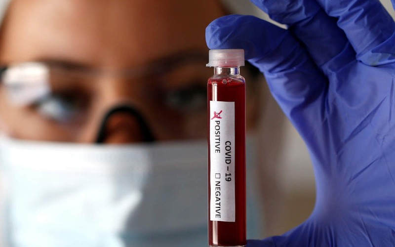 coronatest report